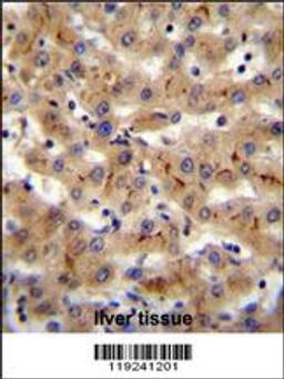 CSAD Antibody immunohistochemistry analysis in formalin fixed and paraffin embedded human liver tissue followed by peroxidase conjugation of the secondary antibody and DAB staining.