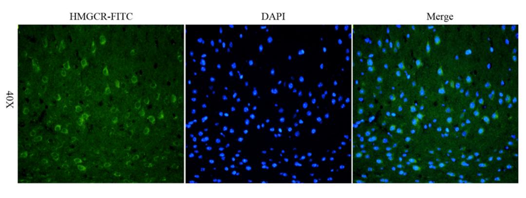 IF analysis of mouse brain tissue using HMGCR (phospho-Ser872) (FITC) (dilution of primary antibody at 1:100)