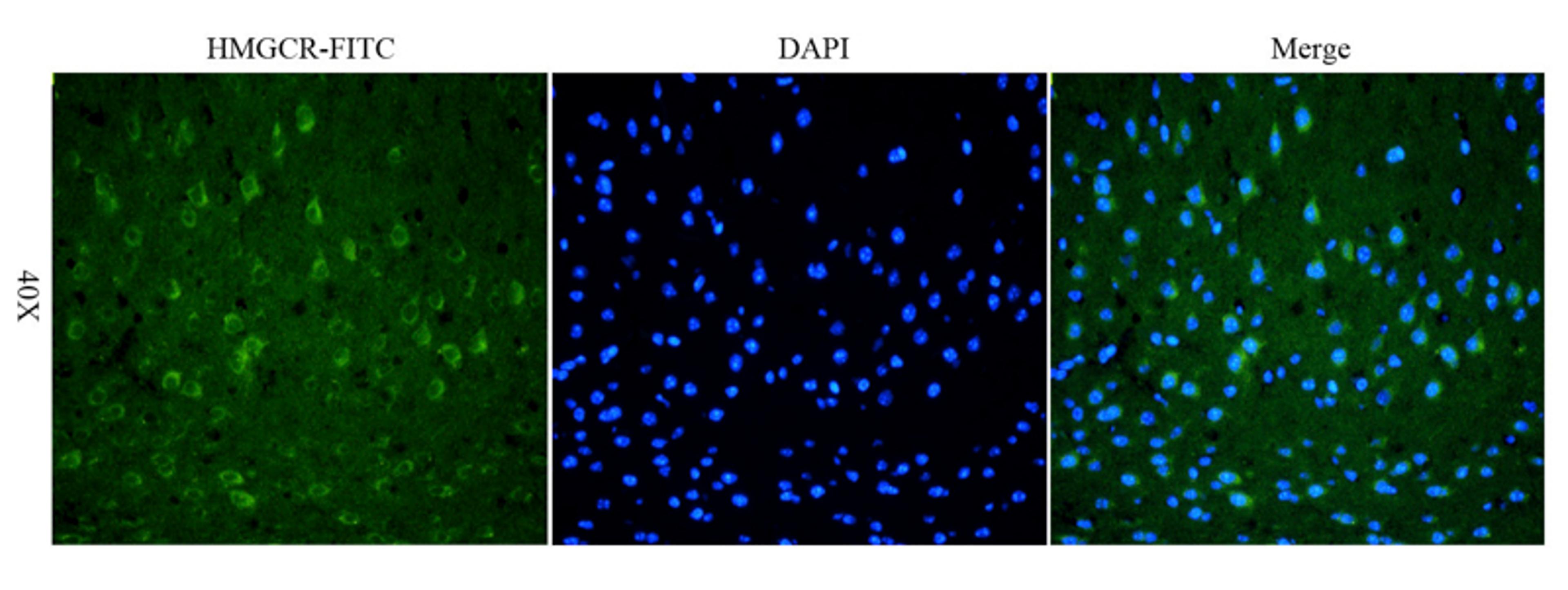 IF analysis of mouse brain tissue using HMGCR (phospho-Ser872) (FITC) (dilution of primary antibody at 1:100)