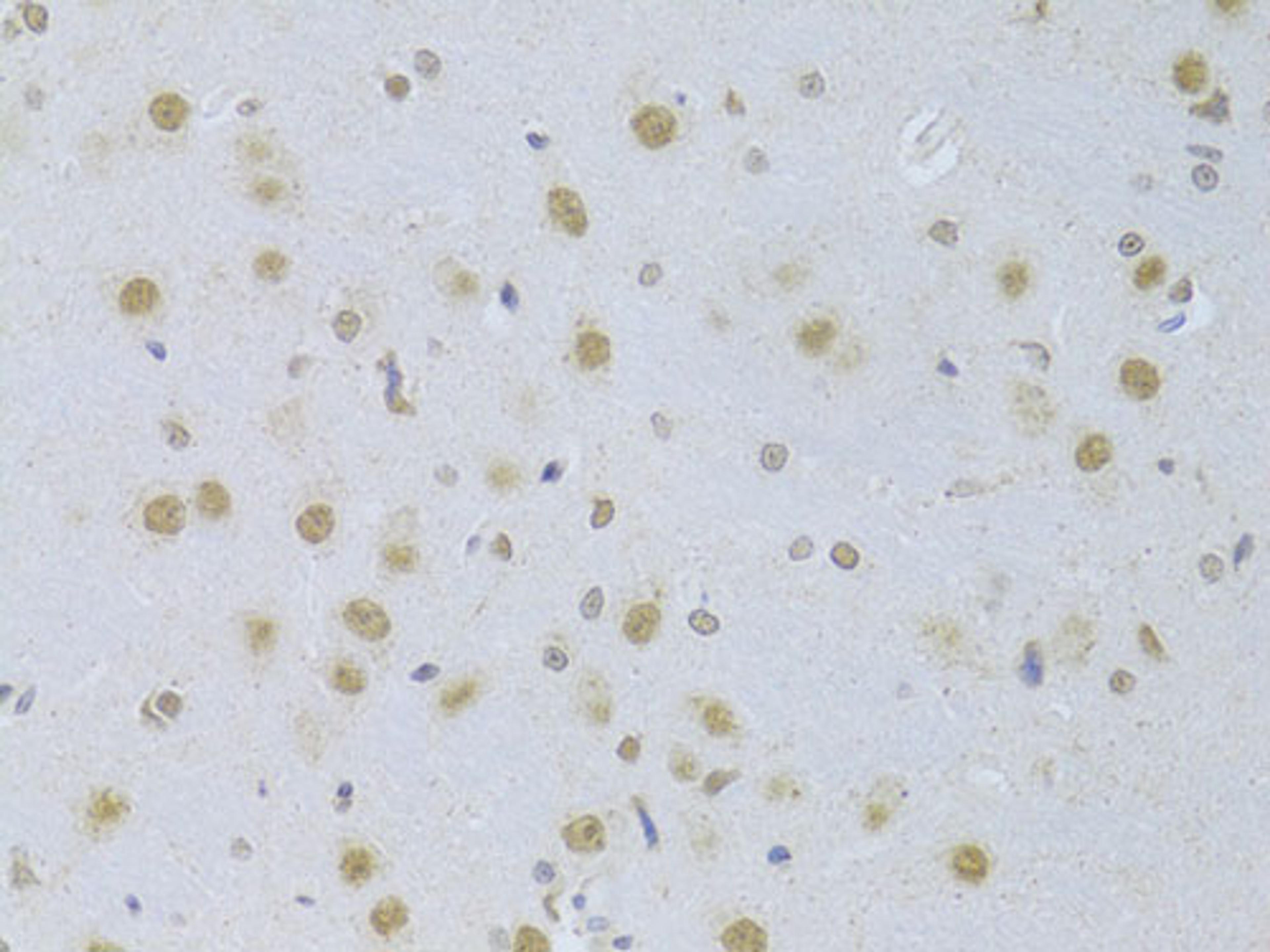 Immunohistochemistry  - CDKN1A/p21CIP1 Antibody (A11454)