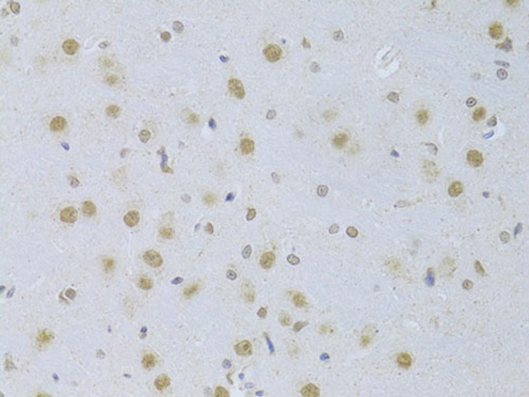 Immunohistochemistry - CDKN1A/p21CIP1 Antibody (A11454)
