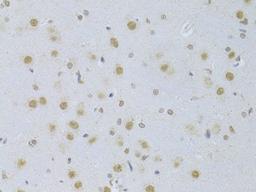 Immunohistochemistry - CDKN1A/p21CIP1 Antibody (A11454)