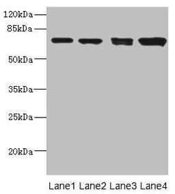 Western blot. All lanes: LINGO antibody at 3.12ug/ml. Lane 1: Mouse lung tissue. Lane 2: Jurkat whole cell lysate. Lane 3: A549 whole cell lysate. Lane 4: HL60 whole cell lysate. Secondary. Goat polyclonal to rabbit IgG at 1/10000 dilution. Predicted band size: 70 kDa. Observed band size: 70 kDa. 