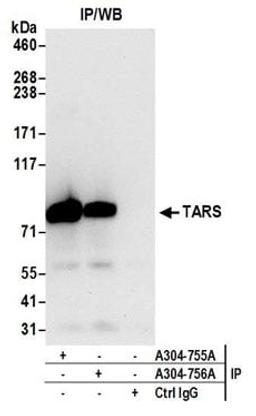 Detection of human TARS by western blot of immunoprecipitates.