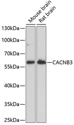 Western blot - CACNB3 antibody (A14710)