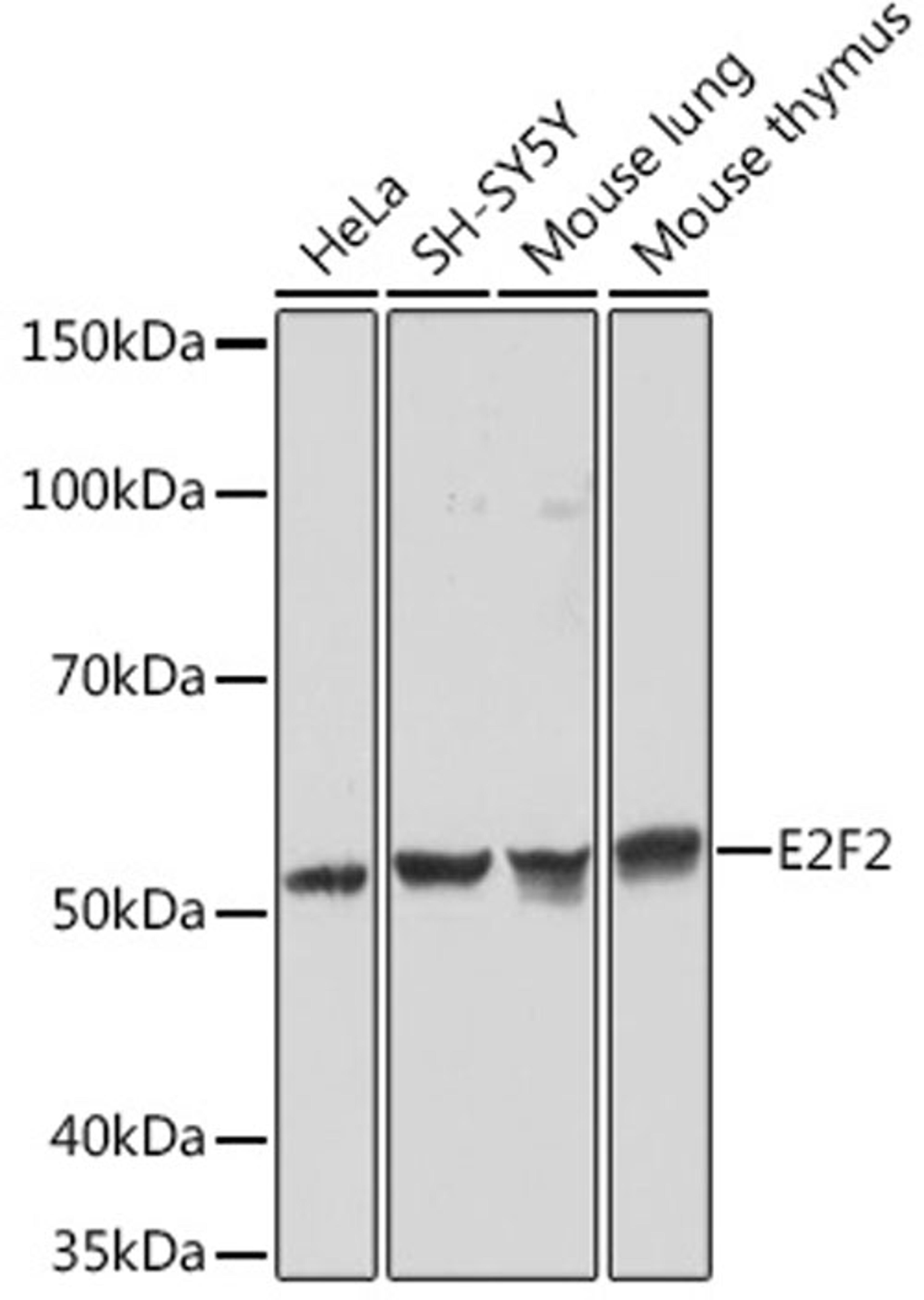Western blot - E2F2 Rabbit mAb (A3297)