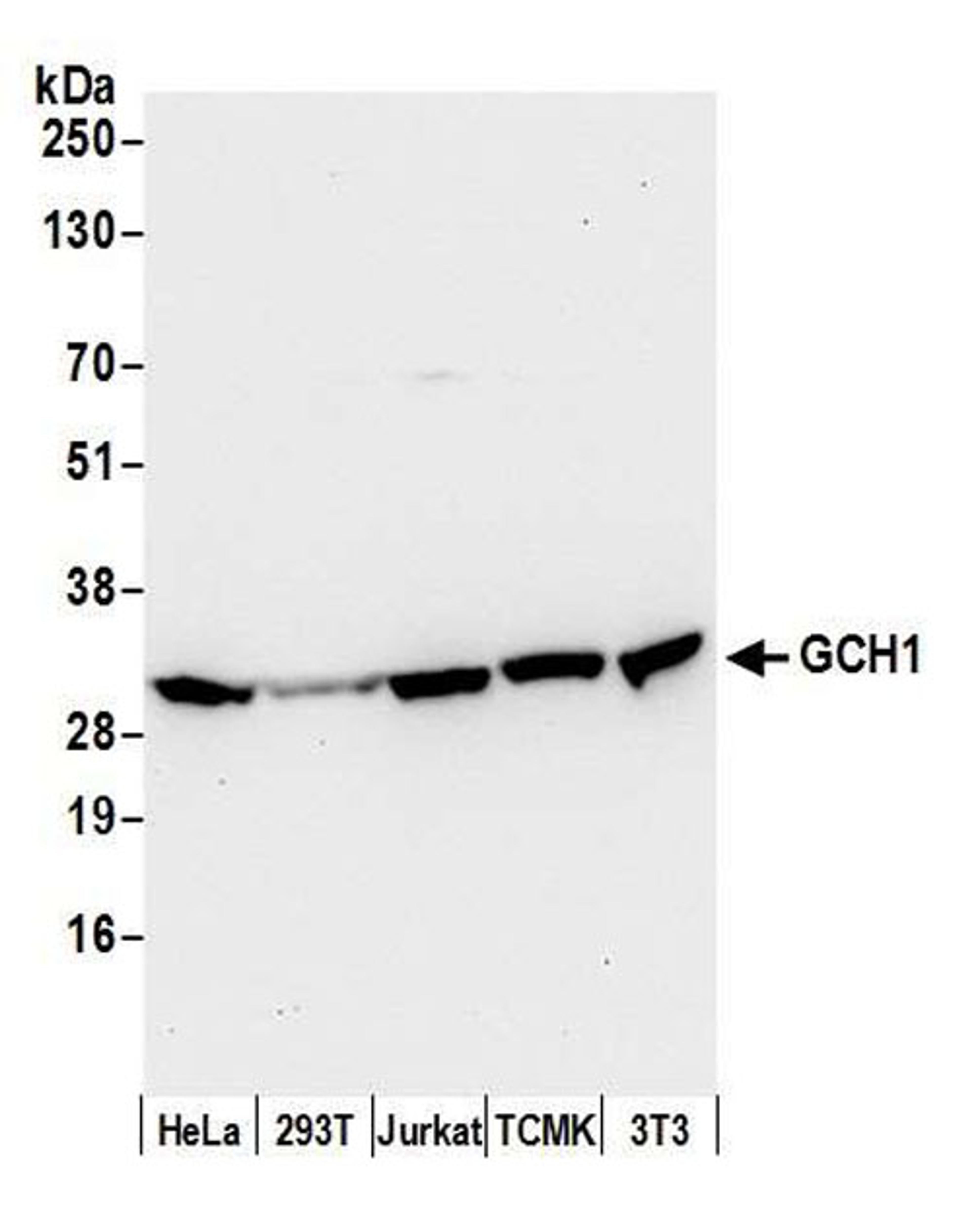 Detection of human and mouse GCH1 by WB.