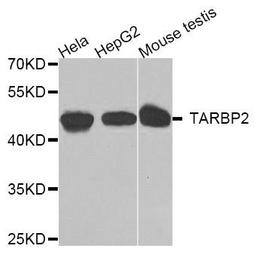 Western blot analysis of extracts of various cell lines using TRBP antibody