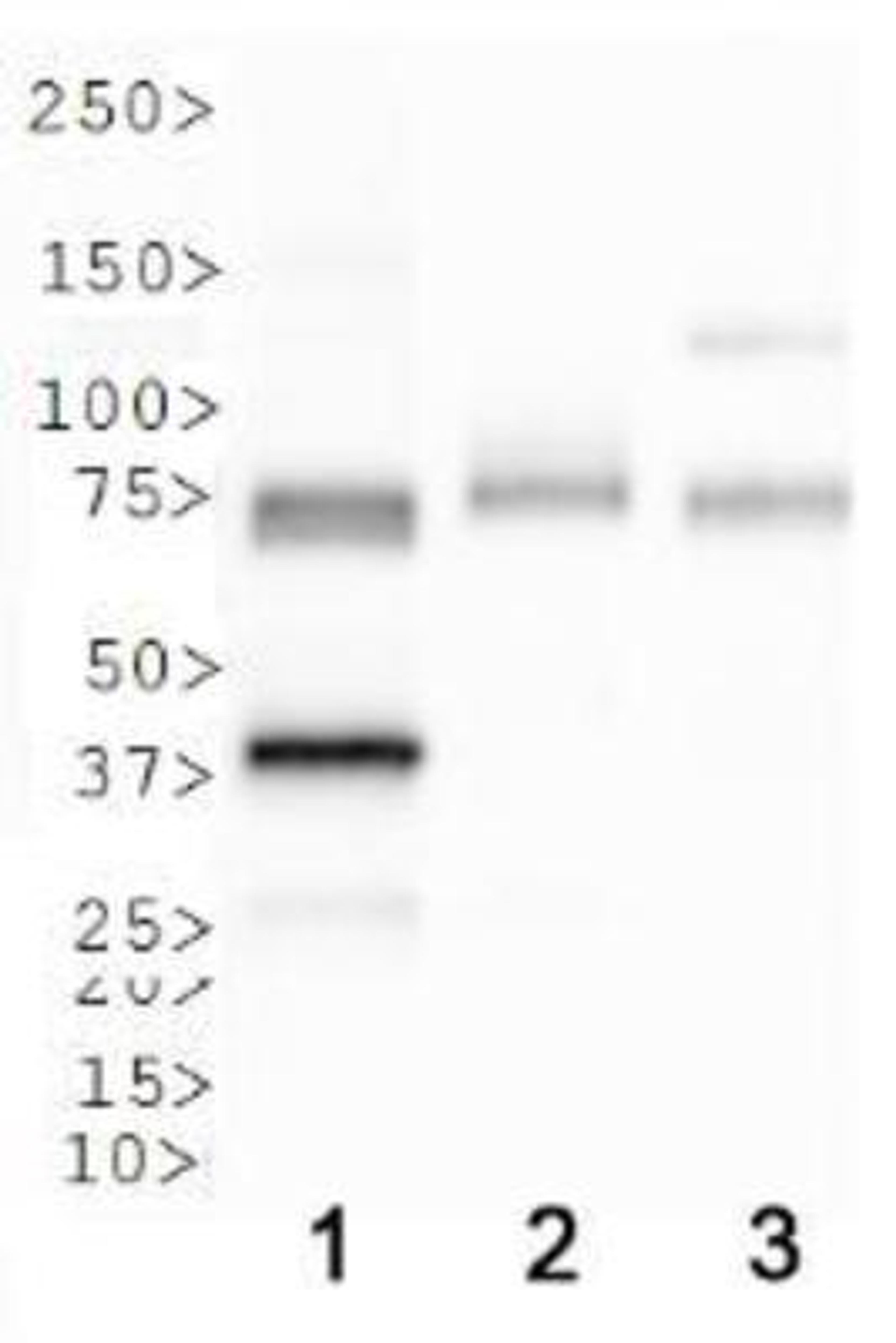 Western Blot: SR-BI Antibody [NB400-131] - WB analysis of SRBI in 1. human liver lysate, 2. mouse liver lysate and 3. rat liver lysate.