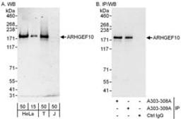 Detection of human ARHGEF10 by western blot and immunoprecipitation.