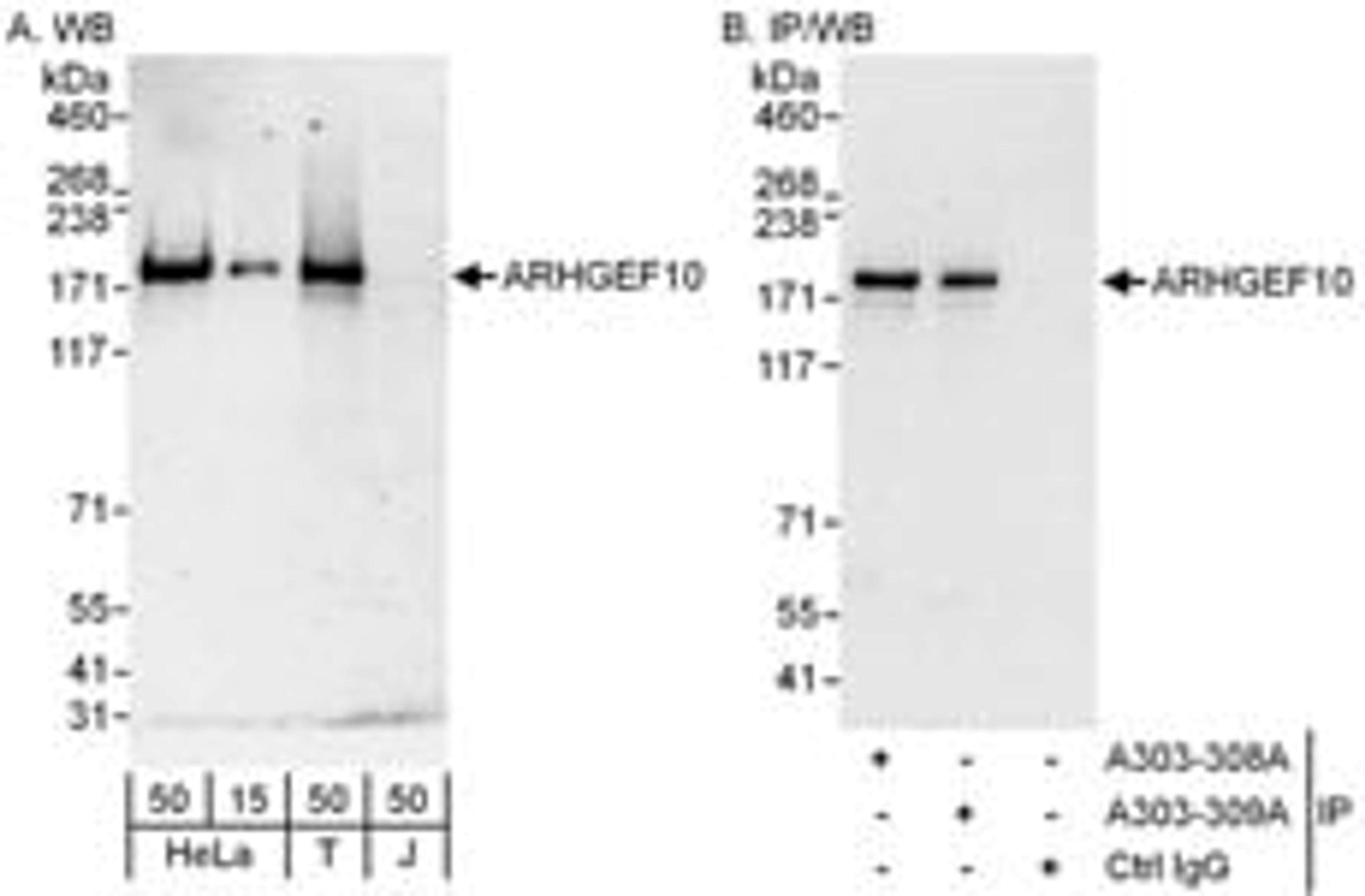 Detection of human ARHGEF10 by western blot and immunoprecipitation.