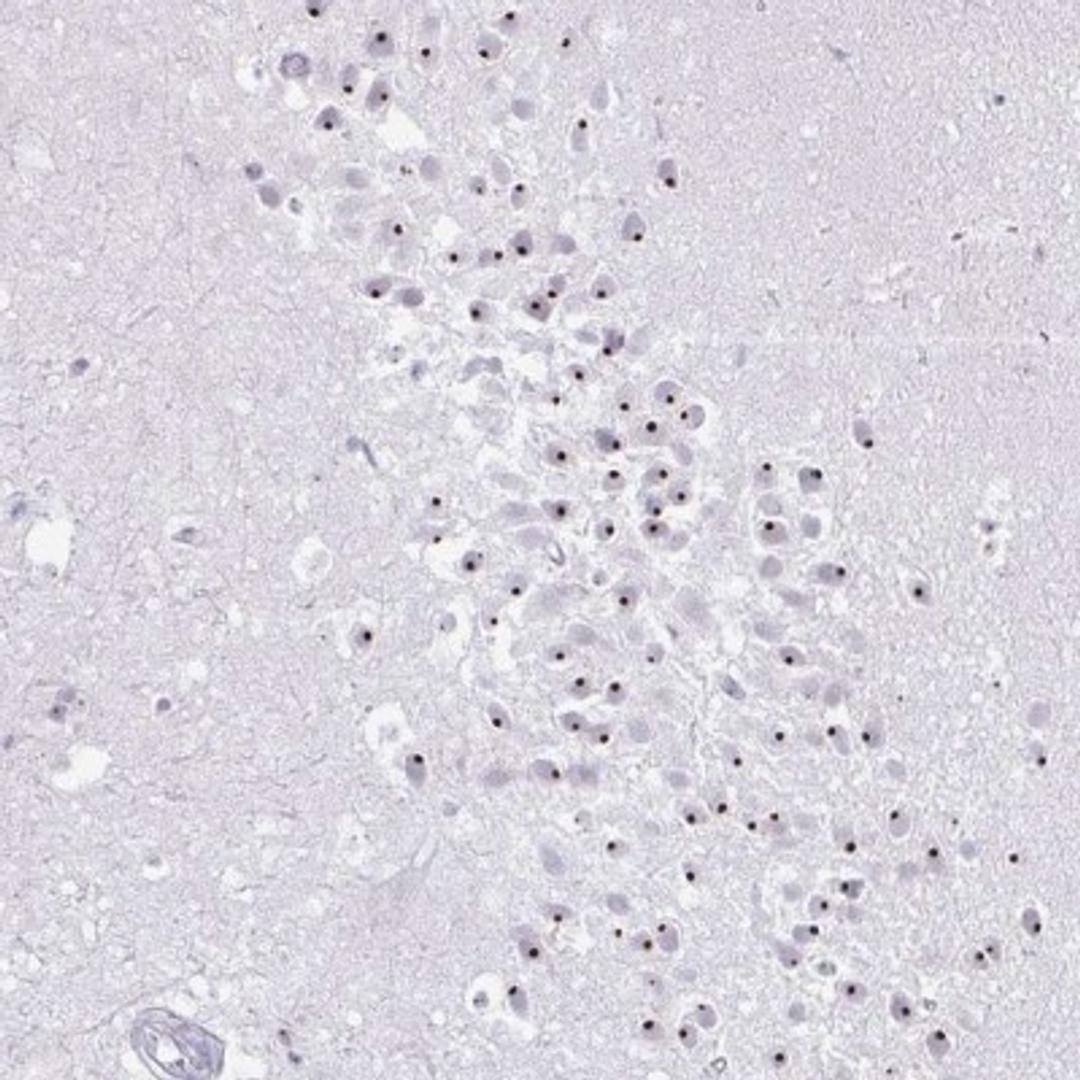 Immunohistochemistry: FAM9A Antibody [NBP2-31622] - Staining of human hippocampus shows strong nuclear positivity in neuronal cells.