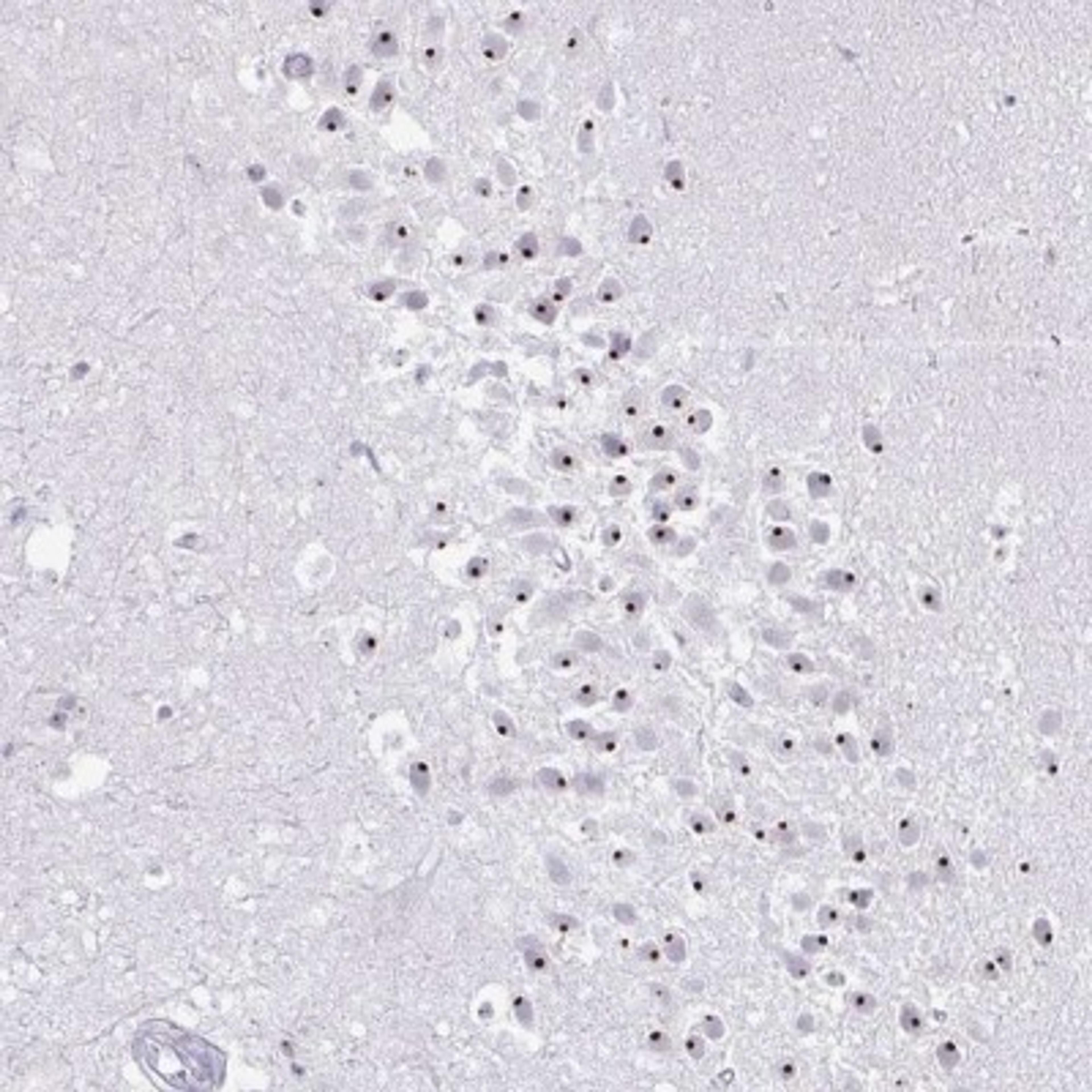 Immunohistochemistry: FAM9A Antibody [NBP2-31622] - Staining of human hippocampus shows strong nuclear positivity in neuronal cells.