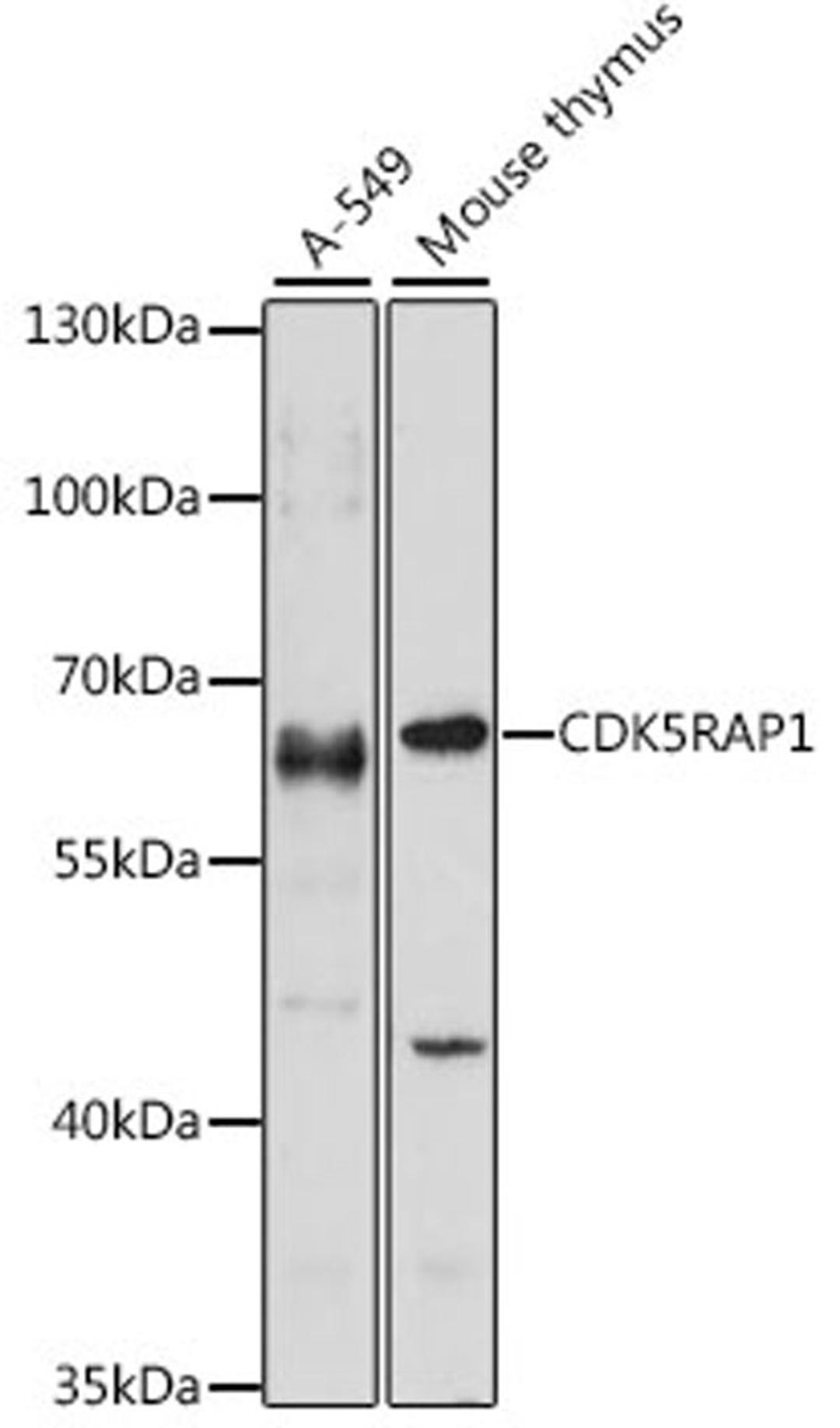 Western blot - CDK5RAP1 antibody (A15844)