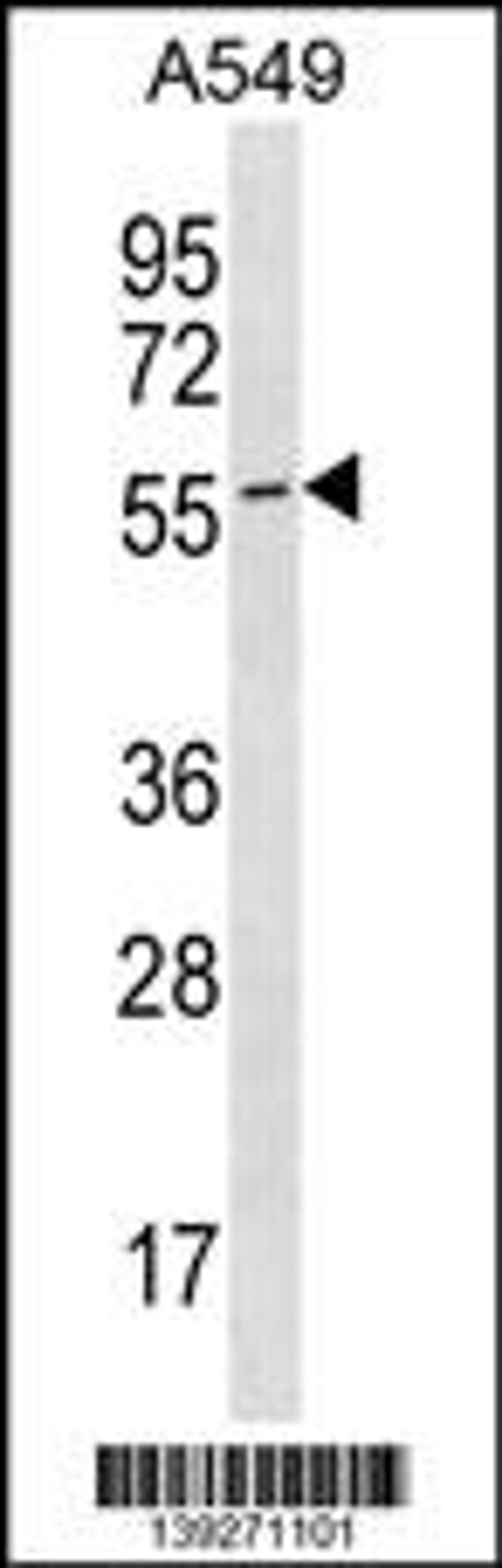 Western blot analysis in A549 cell line lysates (35ug/lane).