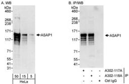 Detection of human ASAP1 by western blot and immunoprecipitation.