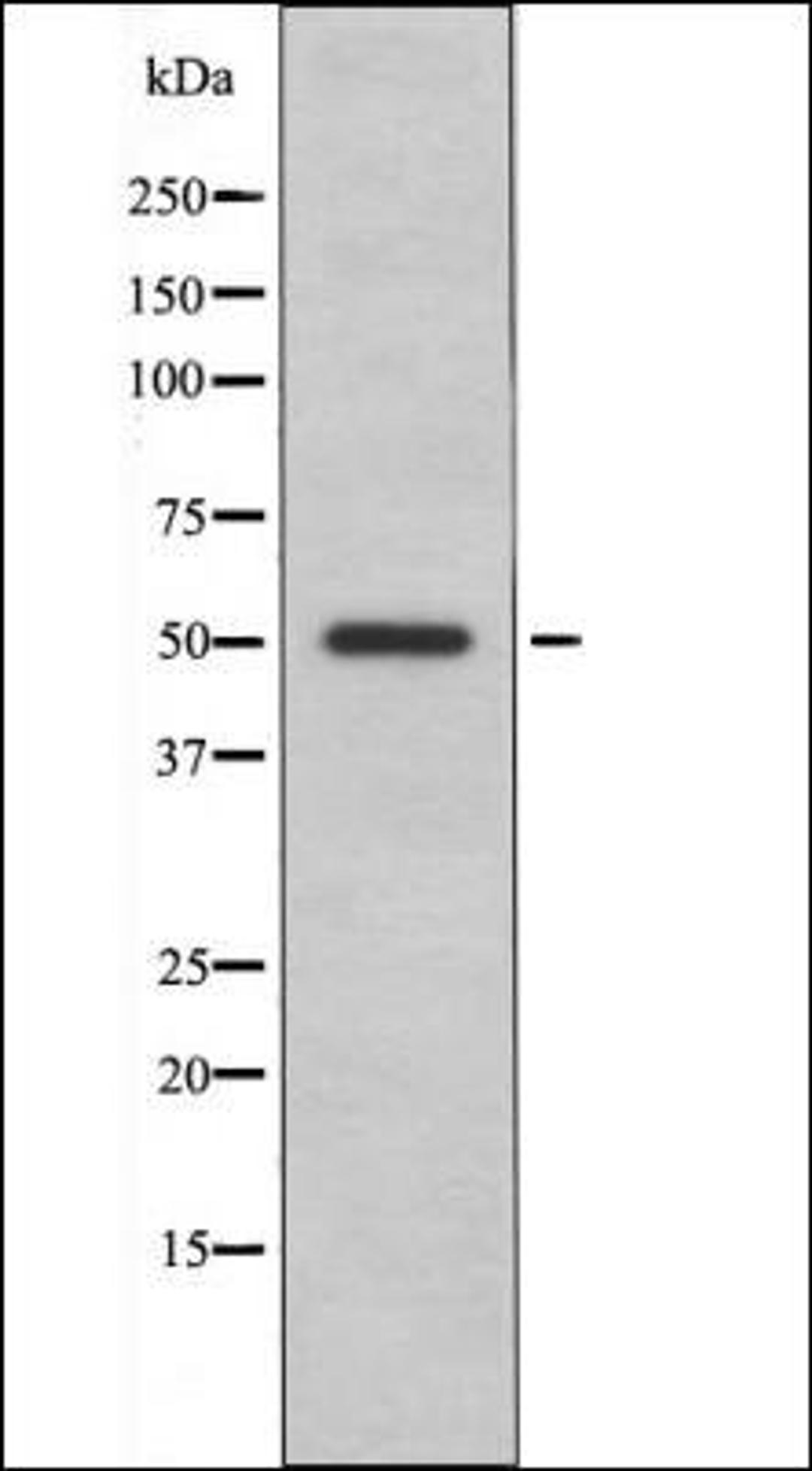 Western blot analysis of EGF treated A431 whole cell lysates using ILK-1 -Phospho-Ser343- antibody