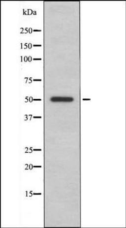 Western blot analysis of EGF treated A431 whole cell lysates using ILK-1 -Phospho-Ser343- antibody