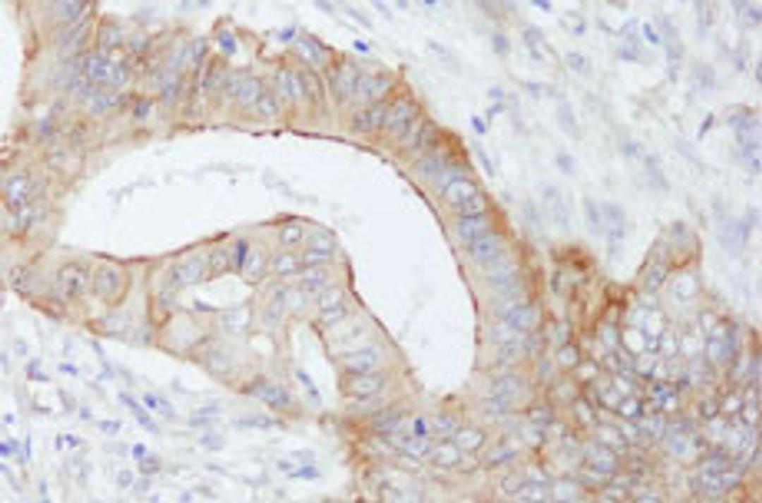 Detection of human SPTBN1 by immunohistochemistry.