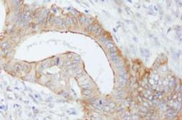 Detection of human SPTBN1 by immunohistochemistry.