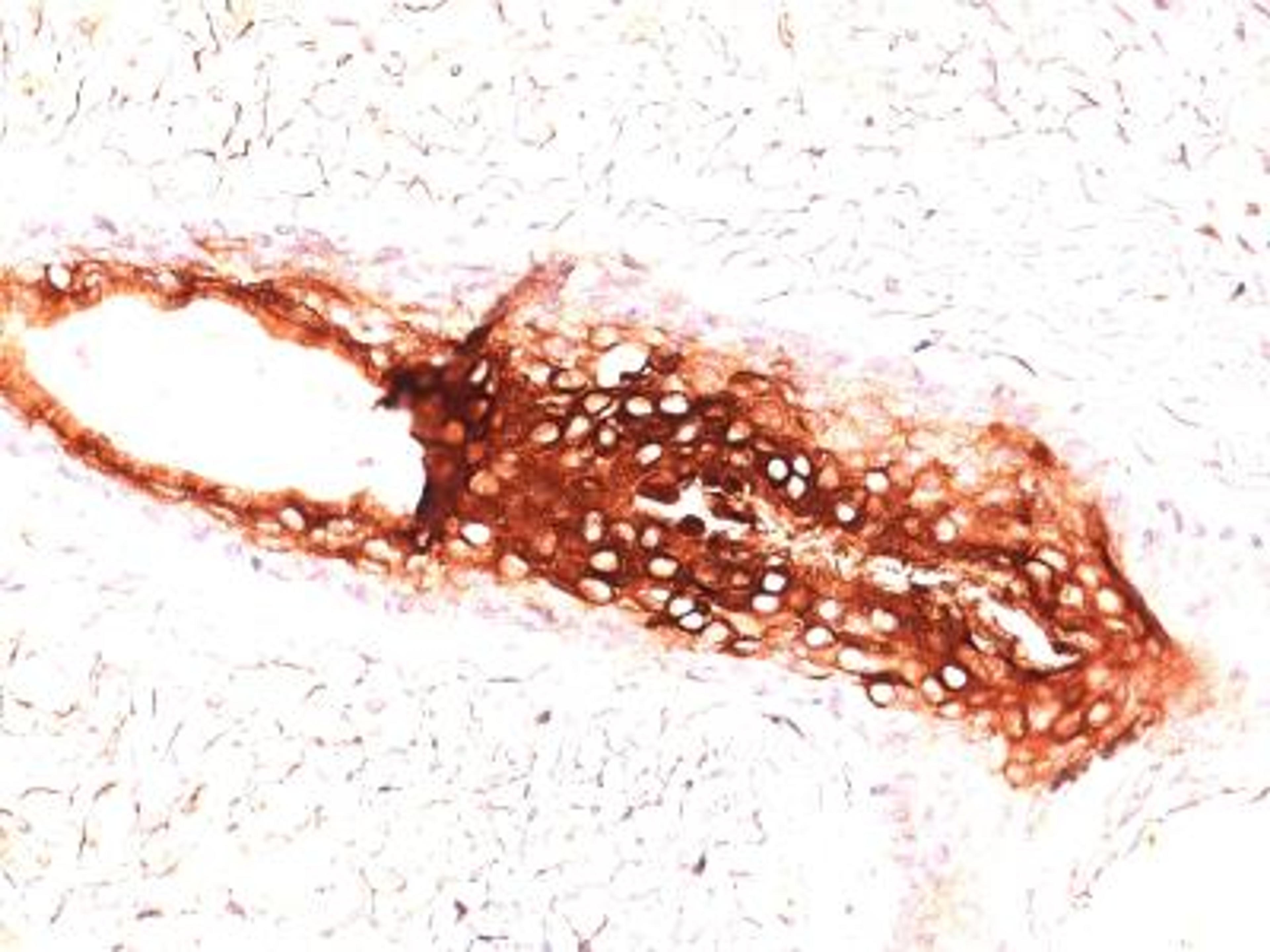 Immunocytochemistry/Immunofluorescence: Cytokeratin 17 Antibody (E3) [NBP2-29421] - Formalin-paraffin skin stained with CK17 Ab (E3).