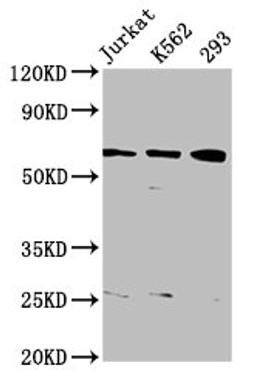 Western Blot. Positive WB detected in: Jurkat whole cell lysate, K562 whole cell lysate, 293 whole cell lysate. All lanes: ELP3 antibody at 3.82µg/ml. Secondary. Goat polyclonal to rabbit IgG at 1/50000 dilution. Predicted band size: 63, 61, 50, 53 kDa. Observed band size: 63 kDa