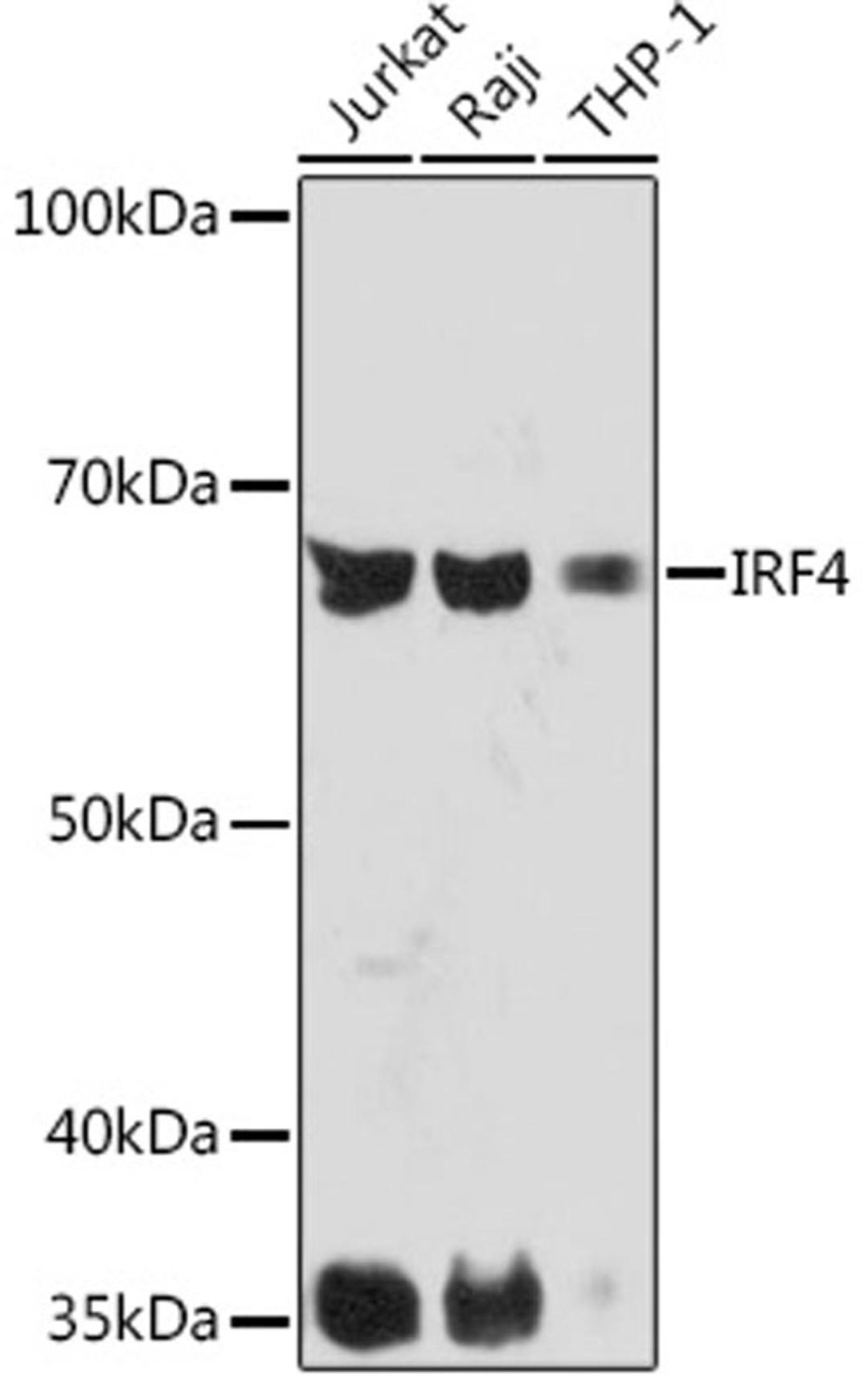 Western blot - IRF4 Rabbit mAb (A5215)