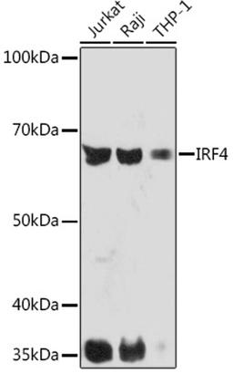 Western blot - IRF4 Rabbit mAb (A5215)