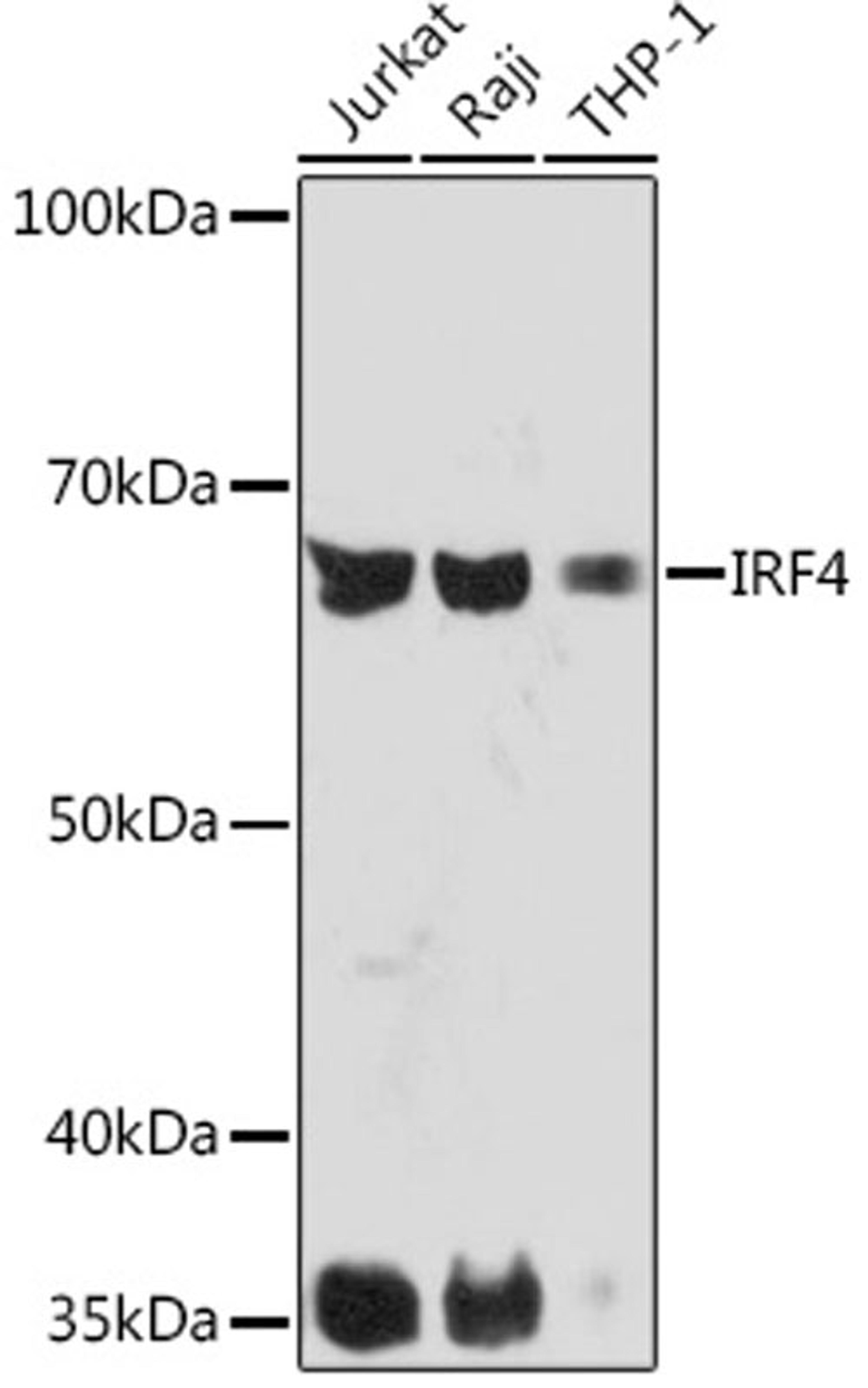 Western blot - IRF4 Rabbit mAb (A5215)