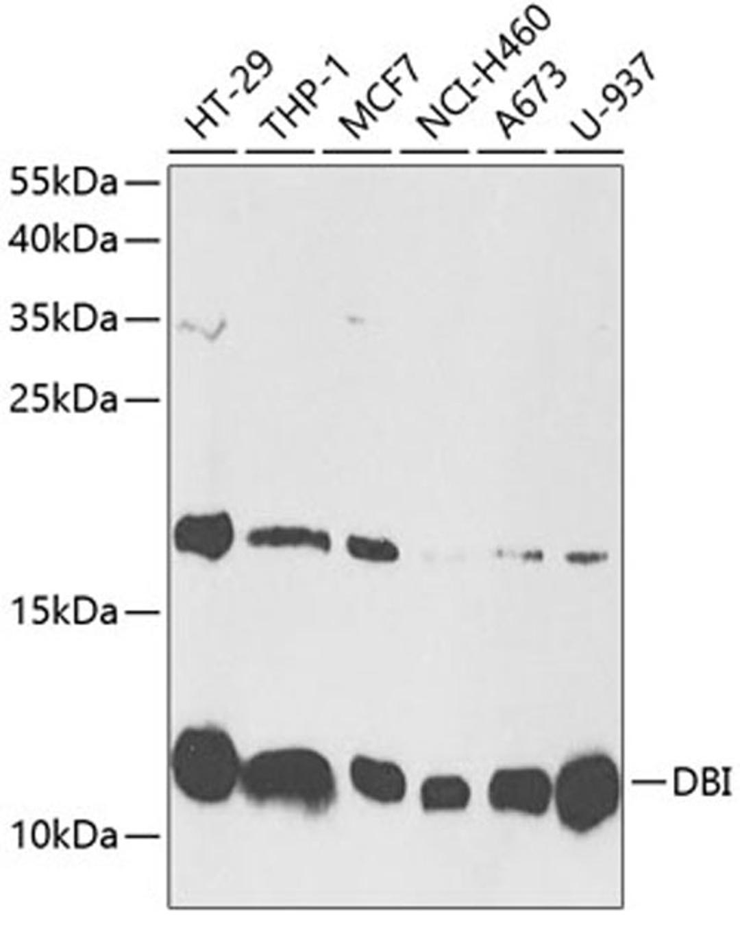 Western blot - DBI antibody (A13293)