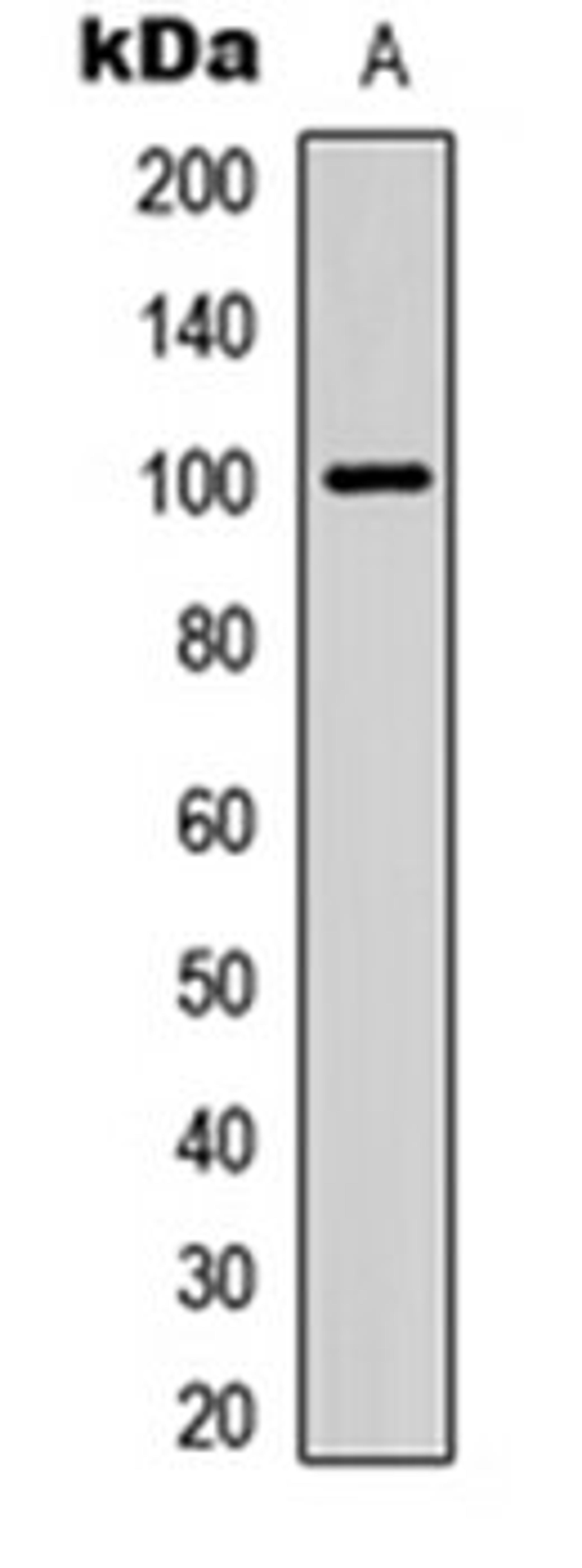 Western blot analysis of HEK293T (Lane 1) whole cell lysates using ITIH3 antibody