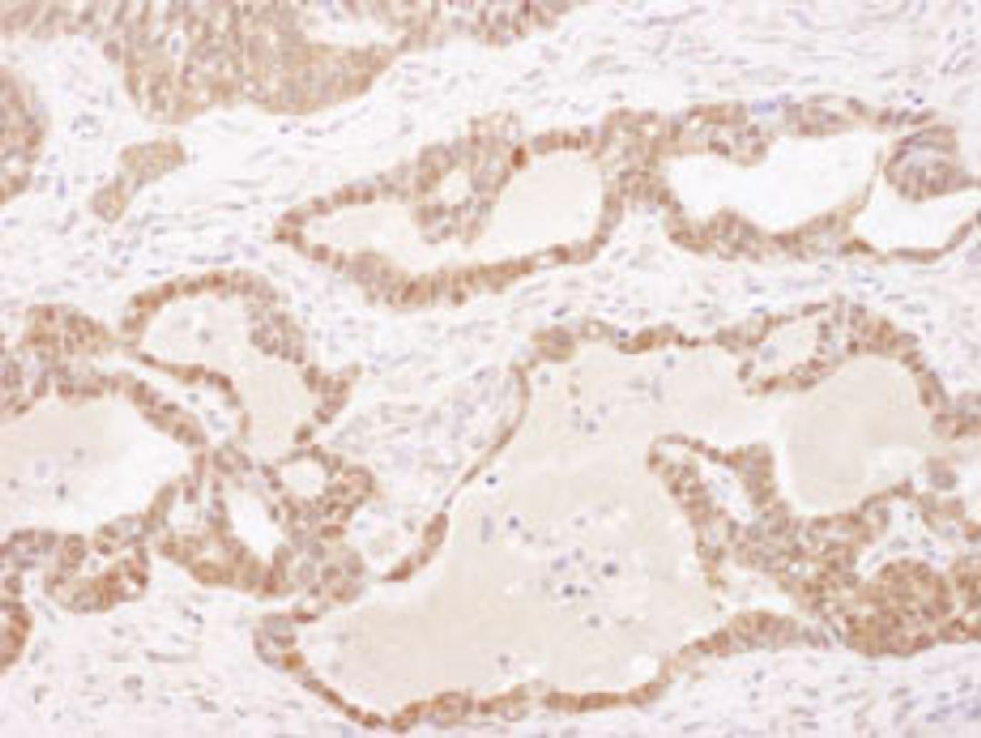 Detection of human GSTP1 by immunohistochemistry.