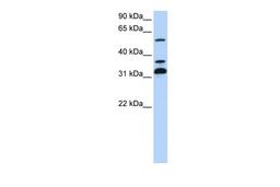 Antibody used in WB on Human 721_B at 0.2-1 ug/ml.