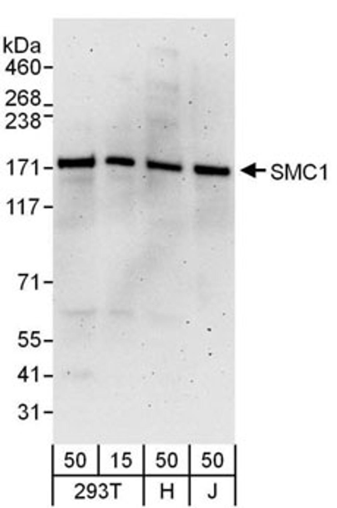 Detection of human SMC1 by western blot.