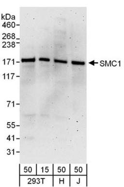 Detection of human SMC1 by western blot.