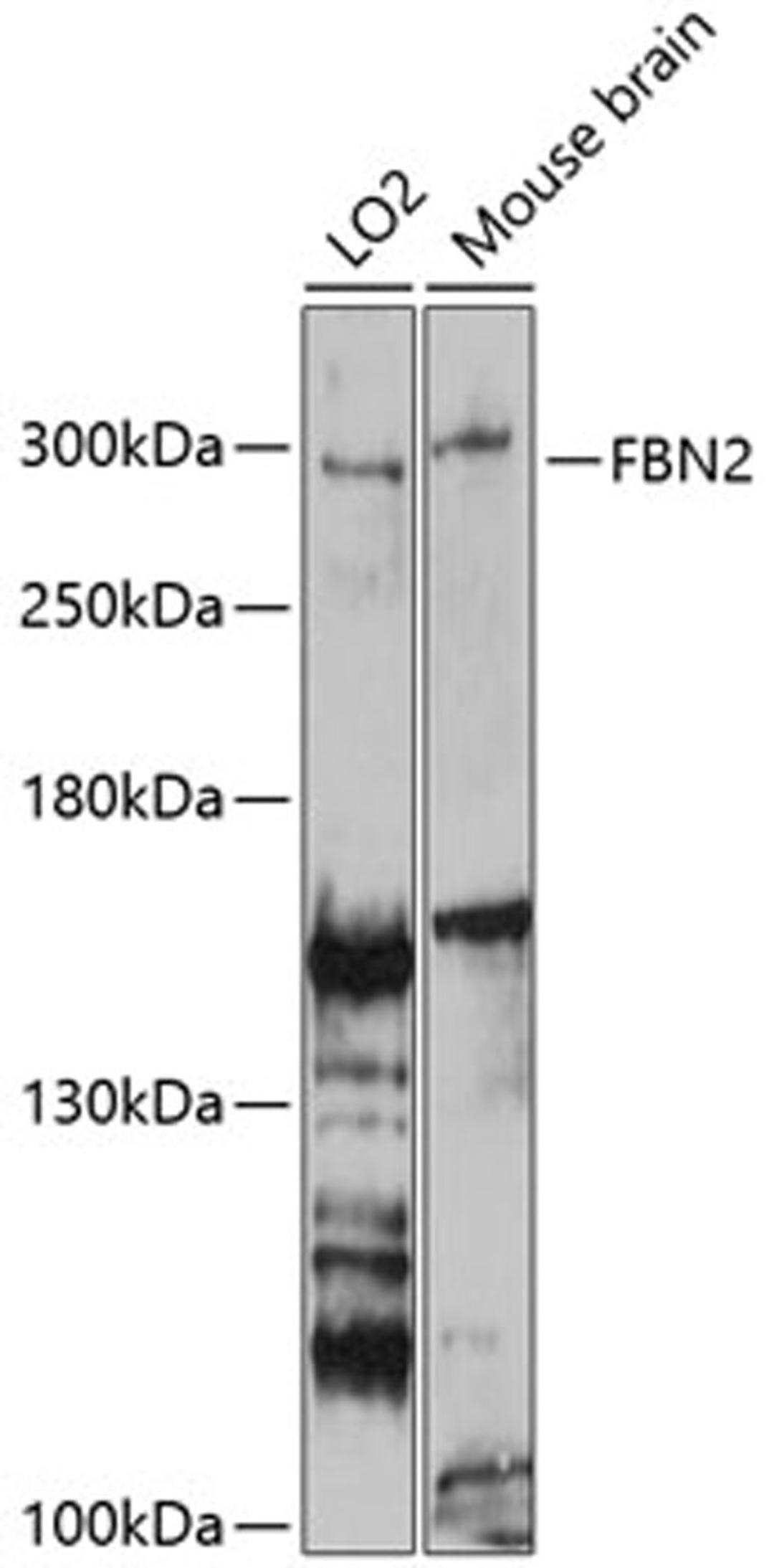 Western blot - FBN2 antibody (A9414)