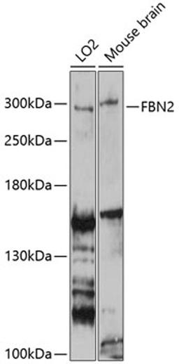 Western blot - FBN2 antibody (A9414)