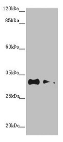 Western blot. All lanes: CNPY3 antibody at 1.2µg/ml. Lane 1: HepG2 whole cell lysate. Lane 2: MCF-7 whole cell lysate. Secondary. Goat polyclonal to rabbit IgG at 1/10000 dilution. Predicted band size: 31, 6 kDa. Observed band size: 31 kDa