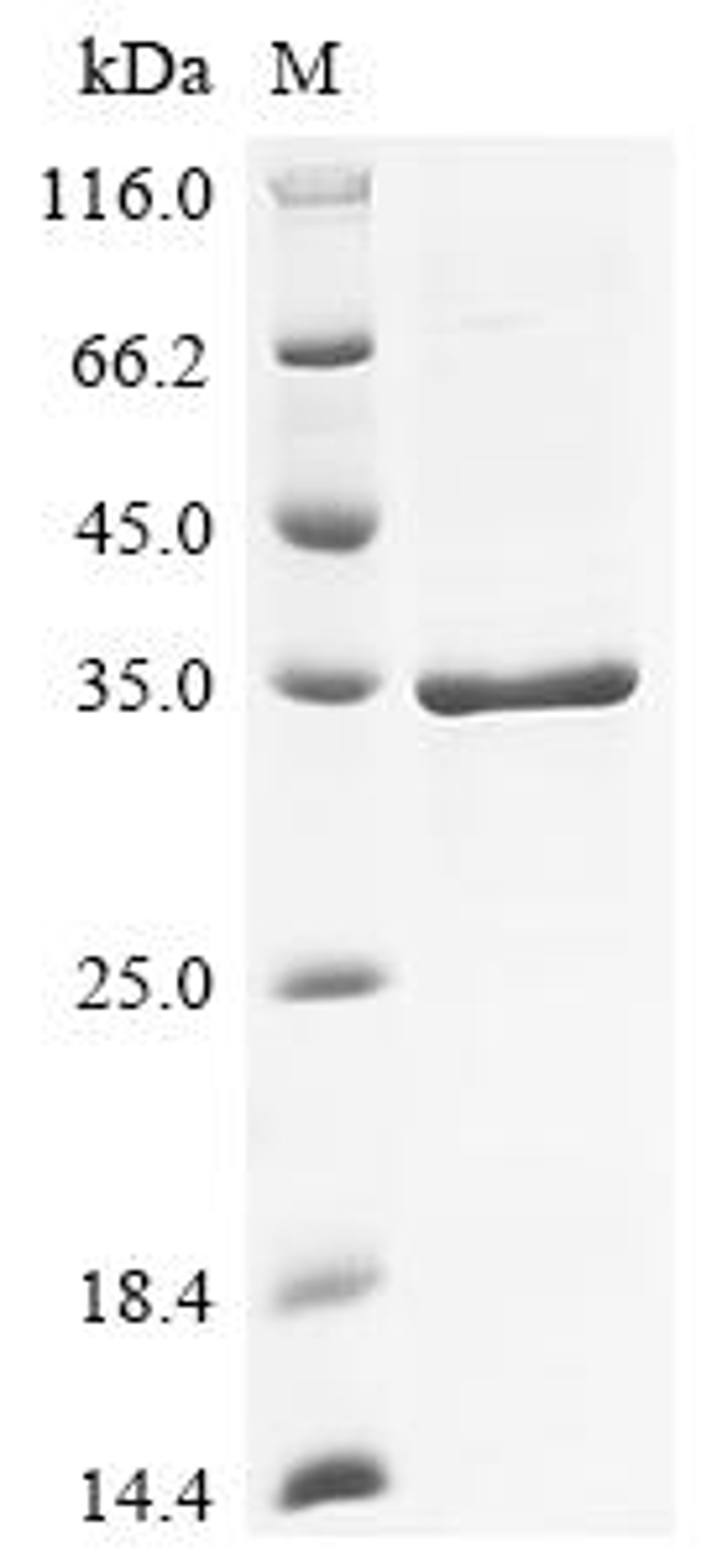 (Tris-Glycine gel) Discontinuous SDS-PAGE (reduced) with 5% enrichment gel and 15% separation gel.