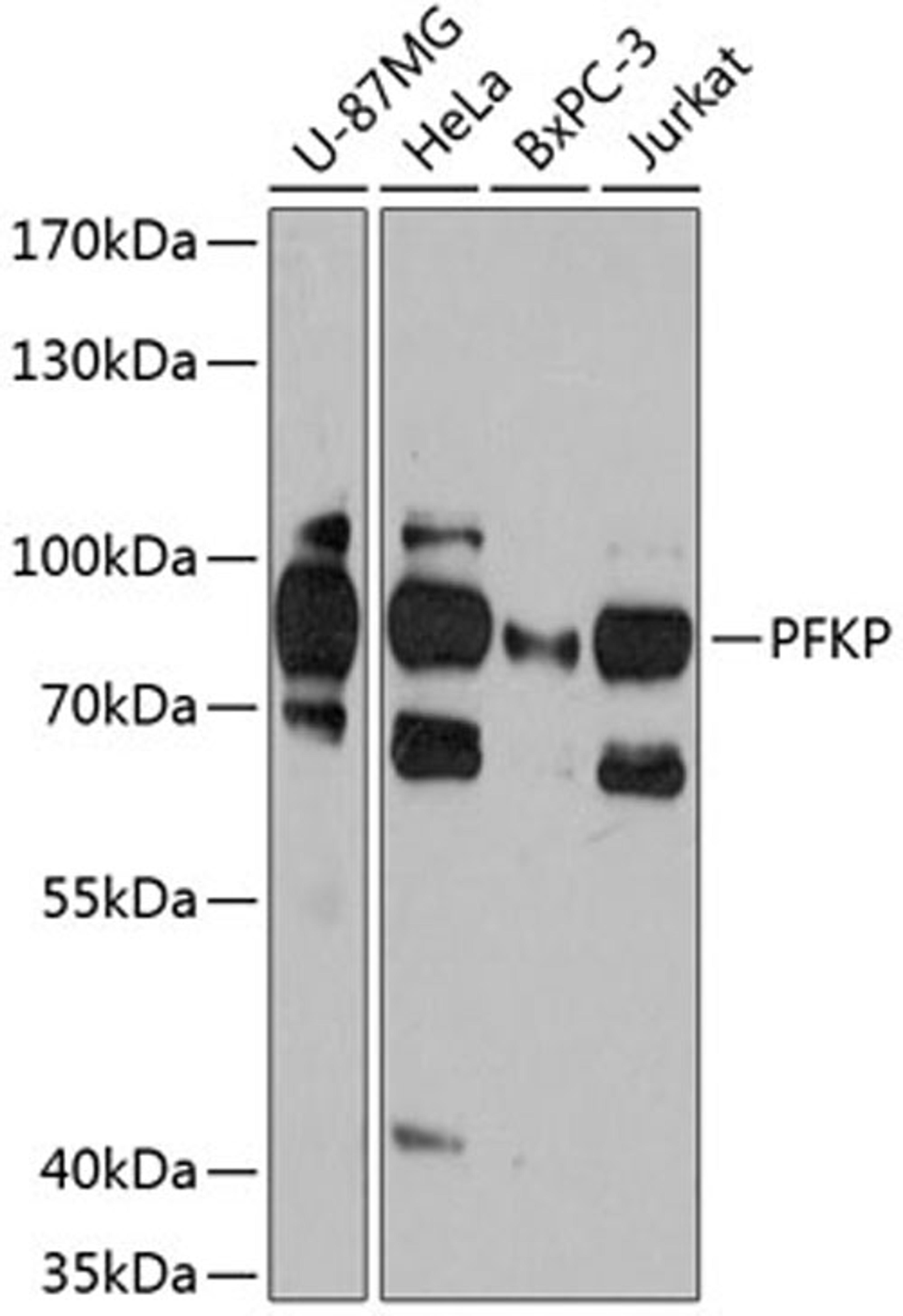 Western blot - PFKP antibody (A12160)