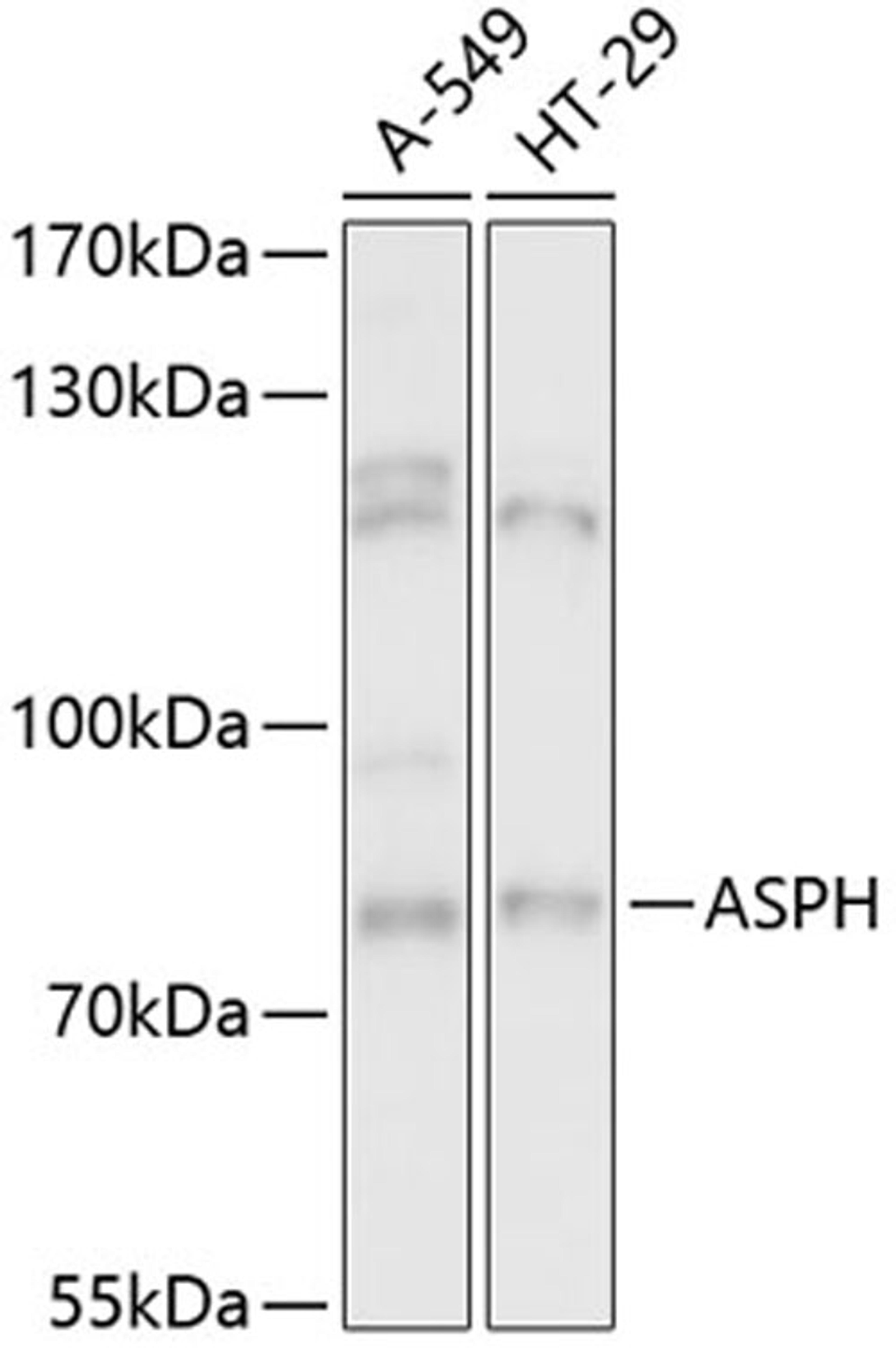 Western blot - ASPH antibody (A13153)