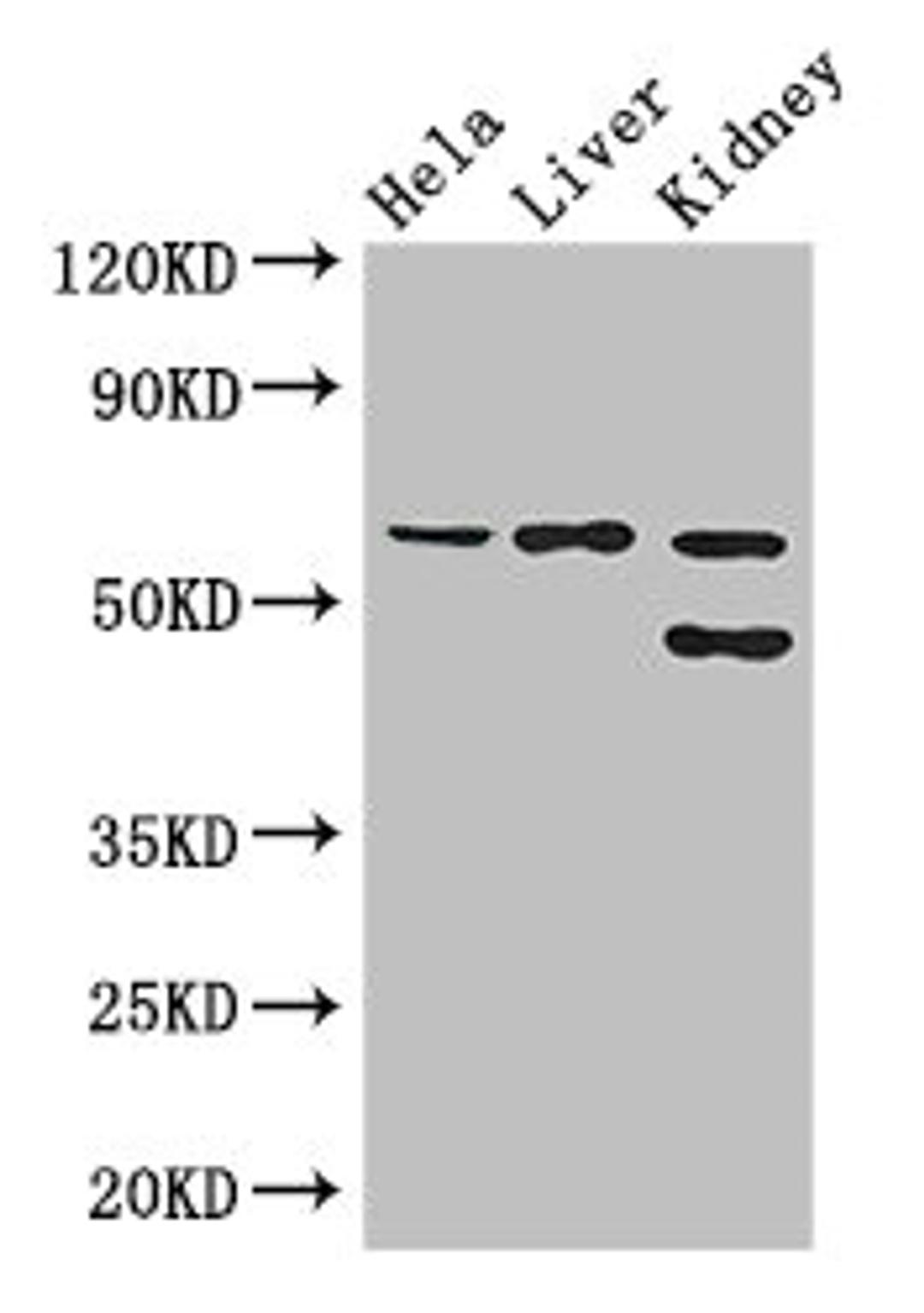 Western Blot. Positive WB detected in: Hela whole cell lysate, Mouse liver tissue, Mouse kidney tissue. All lanes: EHD2 antibody at 3ug/ml. Secondary. Goat polyclonal to rabbit IgG at 1/50000 dilution. Predicted band size: 62, 47 kDa. Observed band size: 62, 47 kDa.