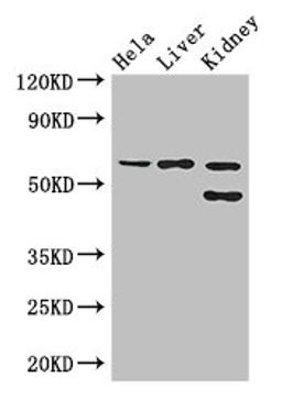 Western Blot. Positive WB detected in: Hela whole cell lysate, Mouse liver tissue, Mouse kidney tissue. All lanes: EHD2 antibody at 3ug/ml. Secondary. Goat polyclonal to rabbit IgG at 1/50000 dilution. Predicted band size: 62, 47 kDa. Observed band size: 62, 47 kDa.