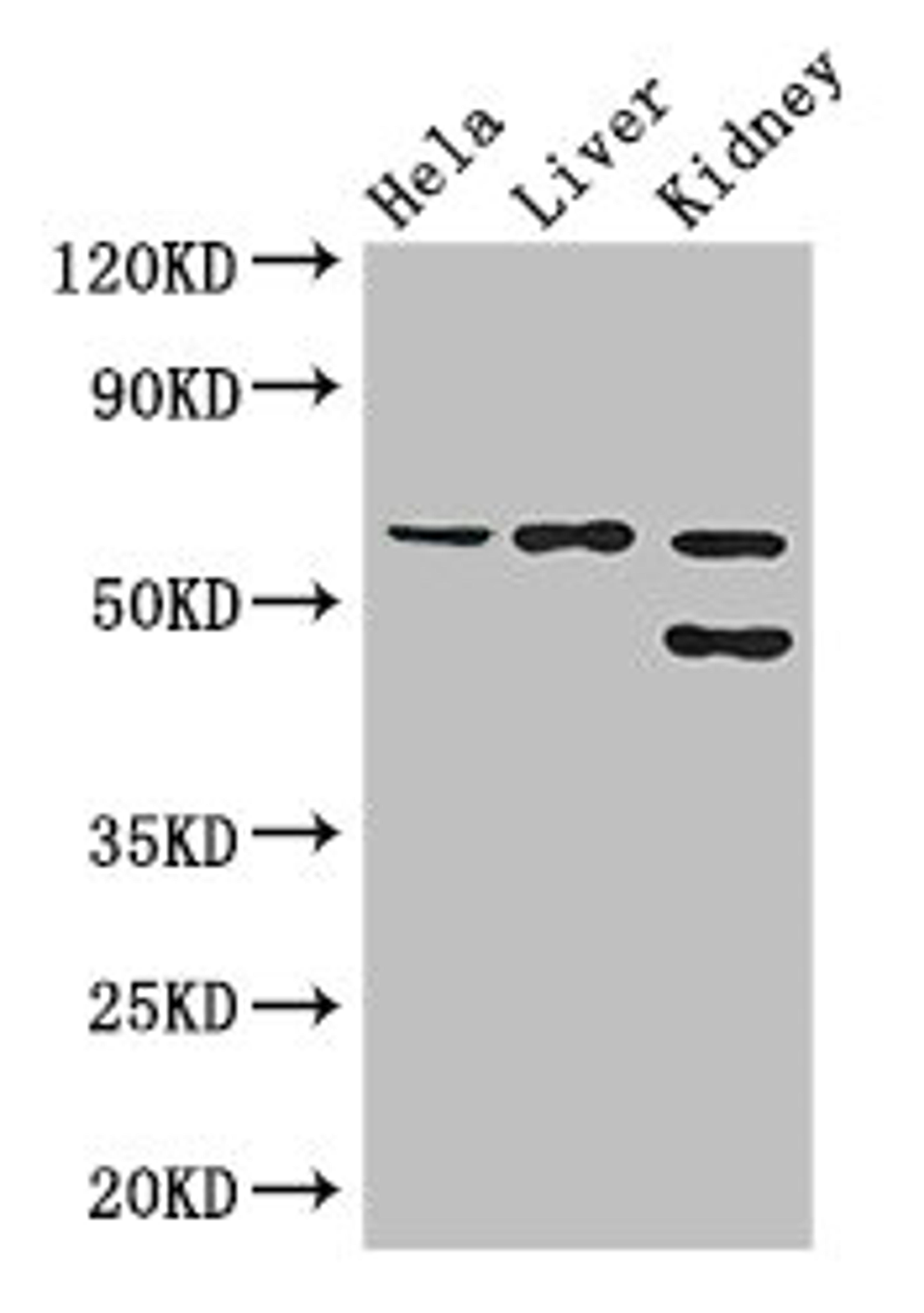 Western Blot. Positive WB detected in: Hela whole cell lysate, Mouse liver tissue, Mouse kidney tissue. All lanes: EHD2 antibody at 3ug/ml. Secondary. Goat polyclonal to rabbit IgG at 1/50000 dilution. Predicted band size: 62, 47 kDa. Observed band size: 62, 47 kDa.