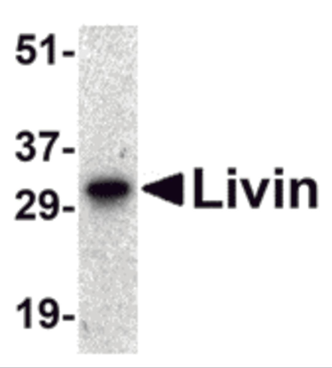 Western blot analysis of Livin expression in human Raji cell lysate with Livin antibody at 0.5 &#956;g/mL. 