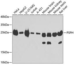 Western blot - PSPH antibody (A7924)