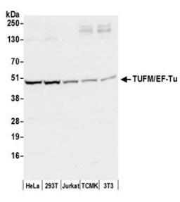 Detection of human and mouse TUFM/EF-Tu by western blot.