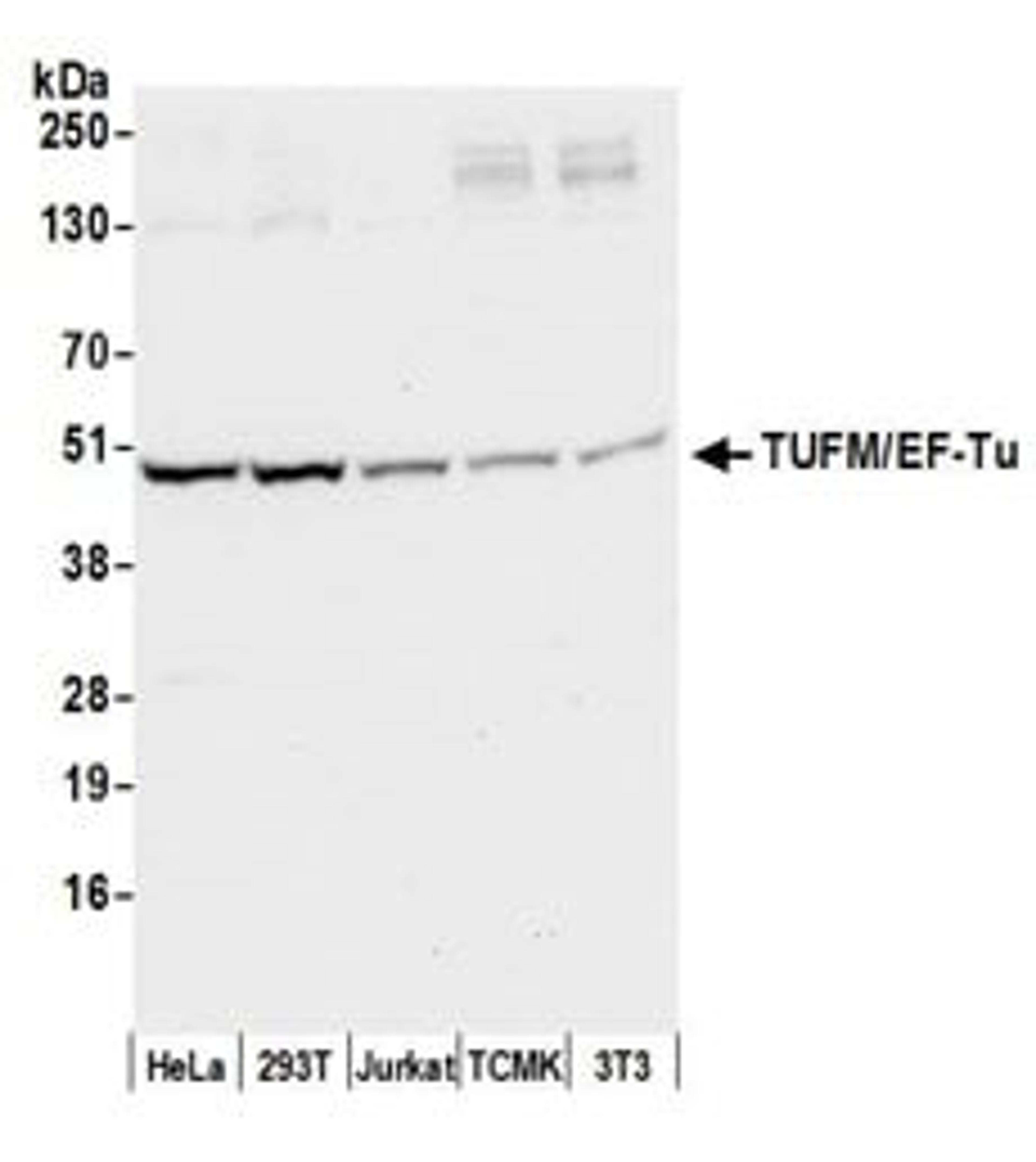 Detection of human and mouse TUFM/EF-Tu by western blot.