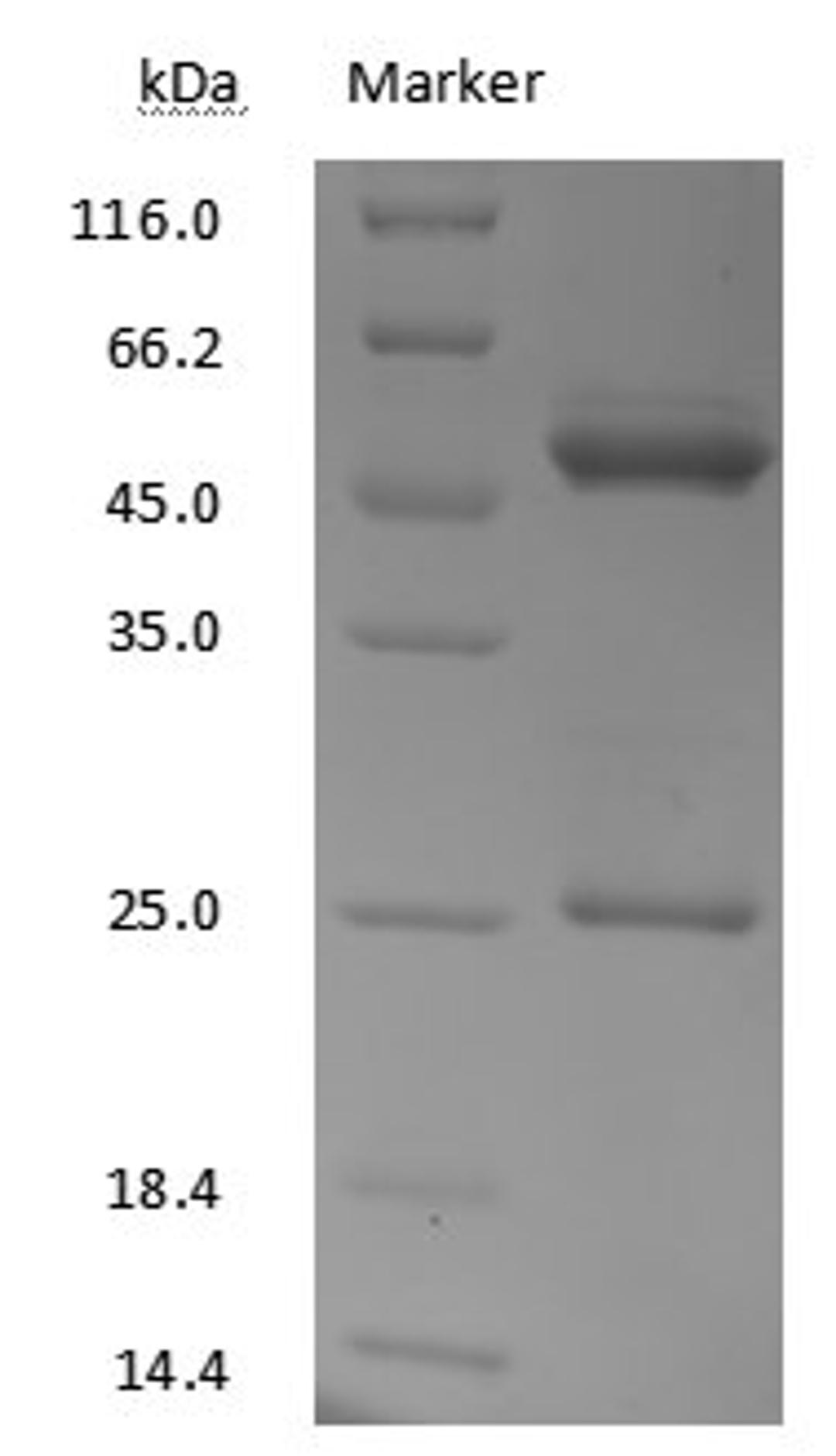 Eribulin antibody on SDS-PAGE under reducing (R) condition. The purity of the protein is greater than 95%.