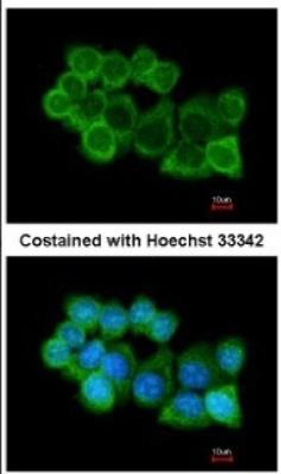 Immunocytochemistry/Immunofluorescence: NAPA Antibody [NBP1-32493] - NAPA Antibody Analysis of methanol-fixed A431, using antibody at 1:200 dilution.